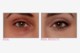 Bye Bye Under Eye™ Concealing Pot Light Bye Bye Under Eye™ Concealing Pot Light