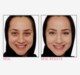 Bye Bye Under Eye™ Concealing Pot Light Bye Bye Under Eye™ Concealing Pot Light