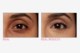 Bye Bye Under Eye™ Concealer Medium Tan Bye Bye Under Eye™ Concealer Medium Tan